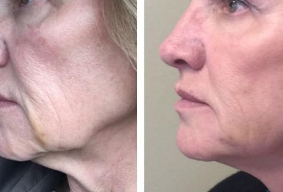 Before / After