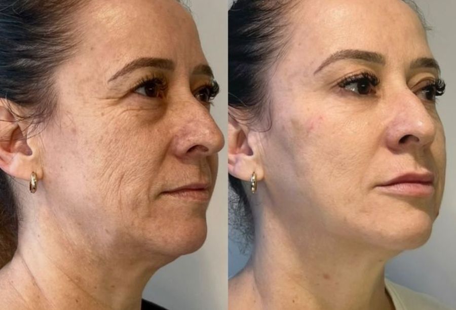 Before / After